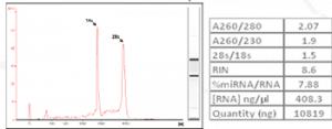 Profile of RNA extracted from a cartilage tumor on Agilent 2100 Bioanalyzer. Table1: Characteristics of total RNA extracted from a cartilage tumor.