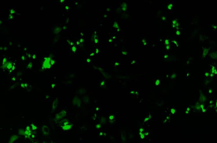 Transfected HeLa cells (GFP F.L.M.), 20X Obj. - #LCACHN-PH20X