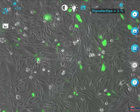 Transfection Efficiency Apps - InCellis Imager - Screen
