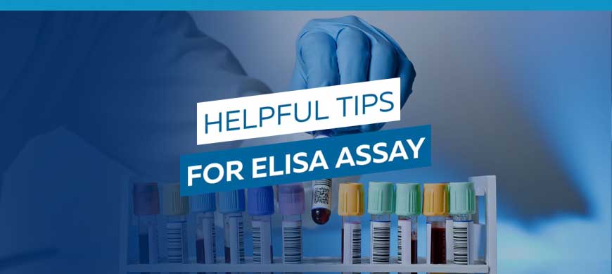 [VIDEO] Helpful tips for a successful ELISA assay Bertin Technologies 41538