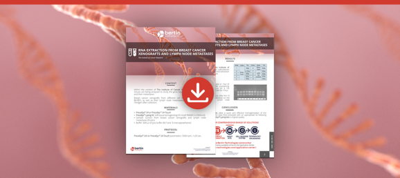 [Application note] RNA extraction from breast cancer xenografts & lymph node metastases with Precellys Bertin Technologies 54386