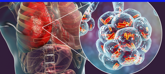 [ARTICLE] Find out how Coriolis μ was used to monitor Legionellosis in healthcare facilities Bertin Technologies 60140