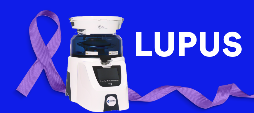 Protected: MMP‑9: A new ally against immune complexes in Lupus Bertin Technologies 82771