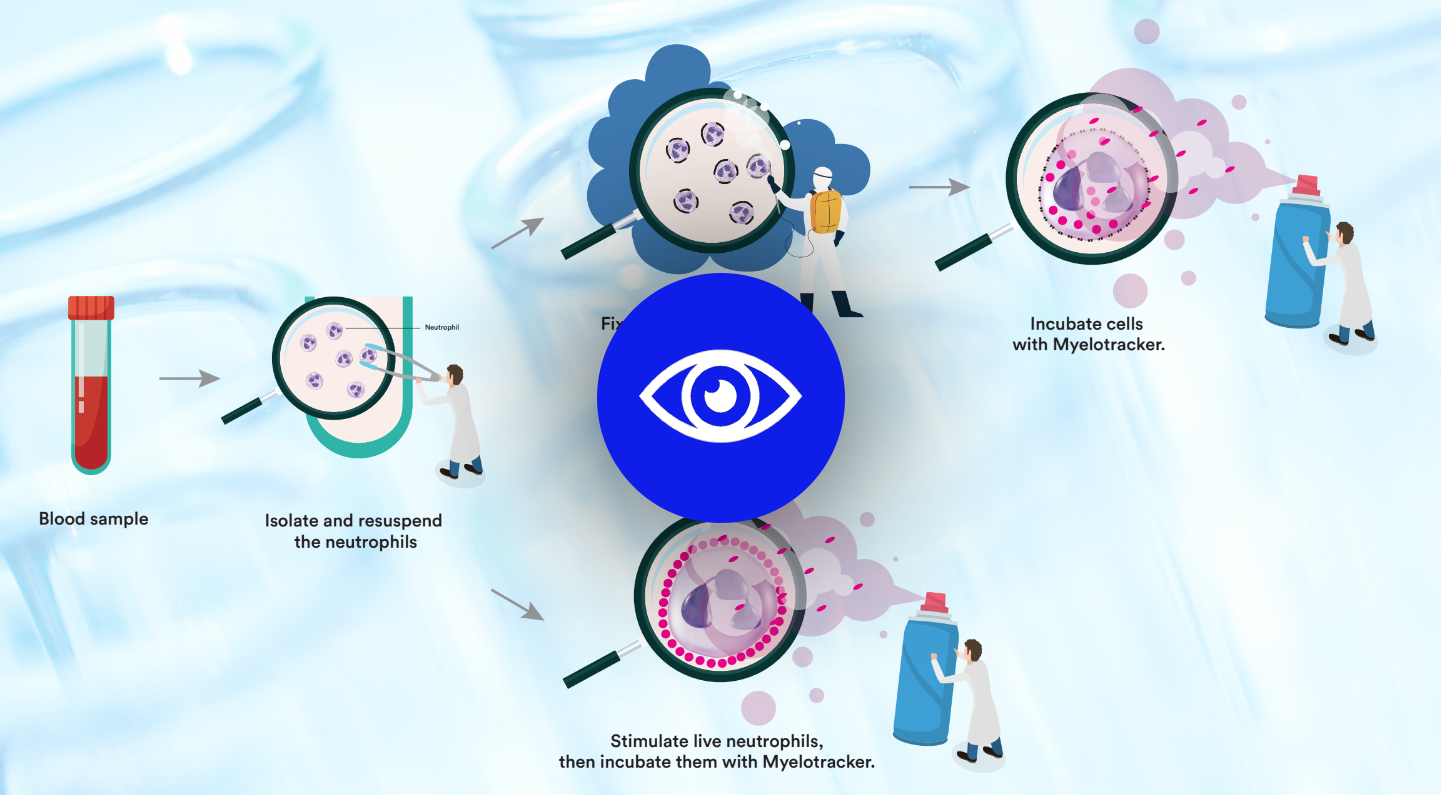 blood sample infography